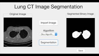Lung CT Image Segmentation​ by Otsu Algorithm