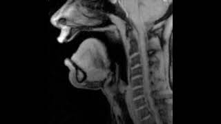 MRI Vowels screenshot 4