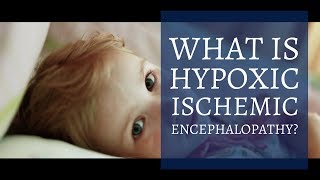What is hypoxic ischemic encephalopathy? | Fischer Redavid Miami Personal Injury Lawyers