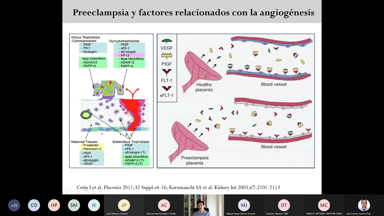 Marcadores Angiogénicos sFlt 1 PIGF en Preeclampsia (Dr. Ignacio Herraiz)