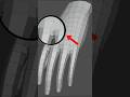 How to make clean hand topology in blender #shorts
