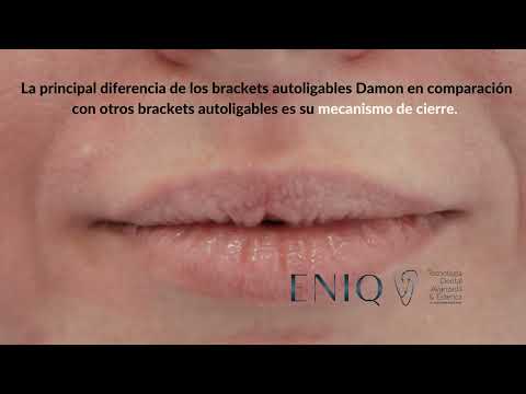 Brackets - ENIQ