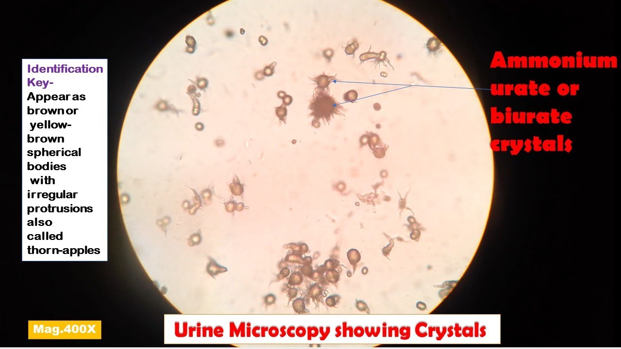 Ammonium Magnesium Phosphate Crystals In Cat Urine at Rebecca Lyles blog