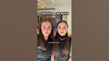 BOTOX VS NO BOTOX #antiaging #botulinumtoxin