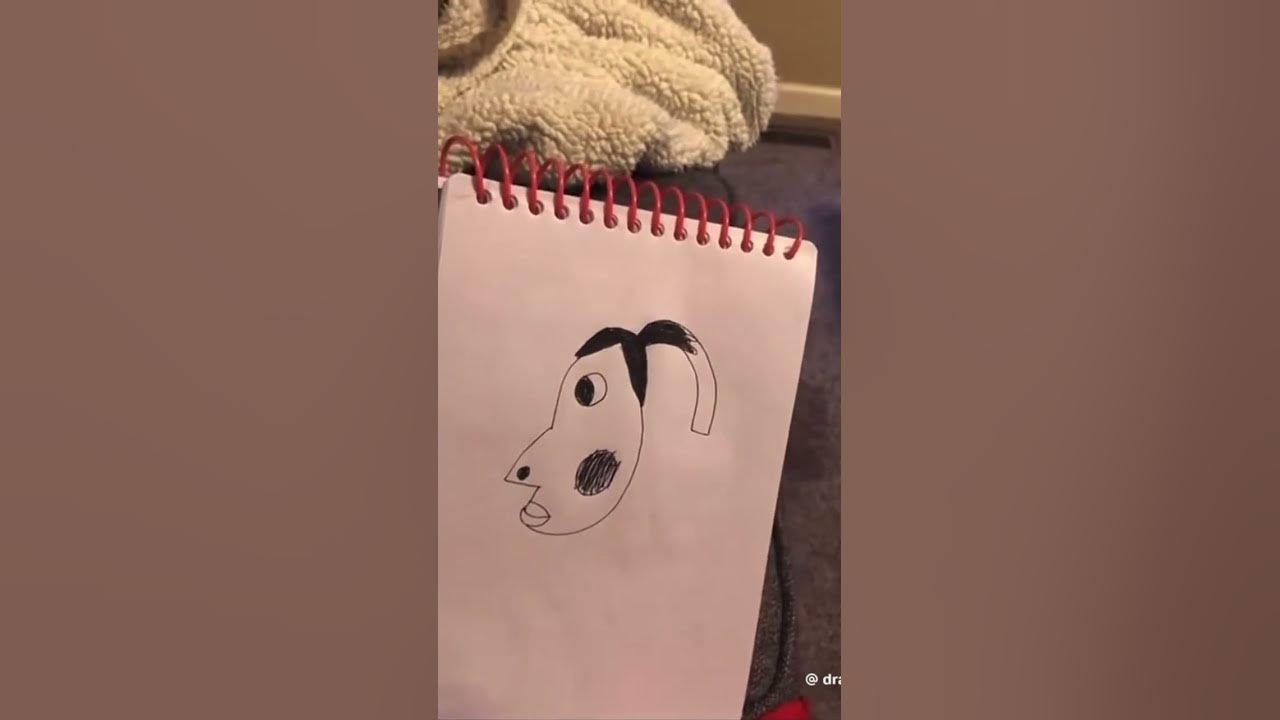 Hyperpigmentation meme from tiktok to youtubeshorts fyp tiktok 