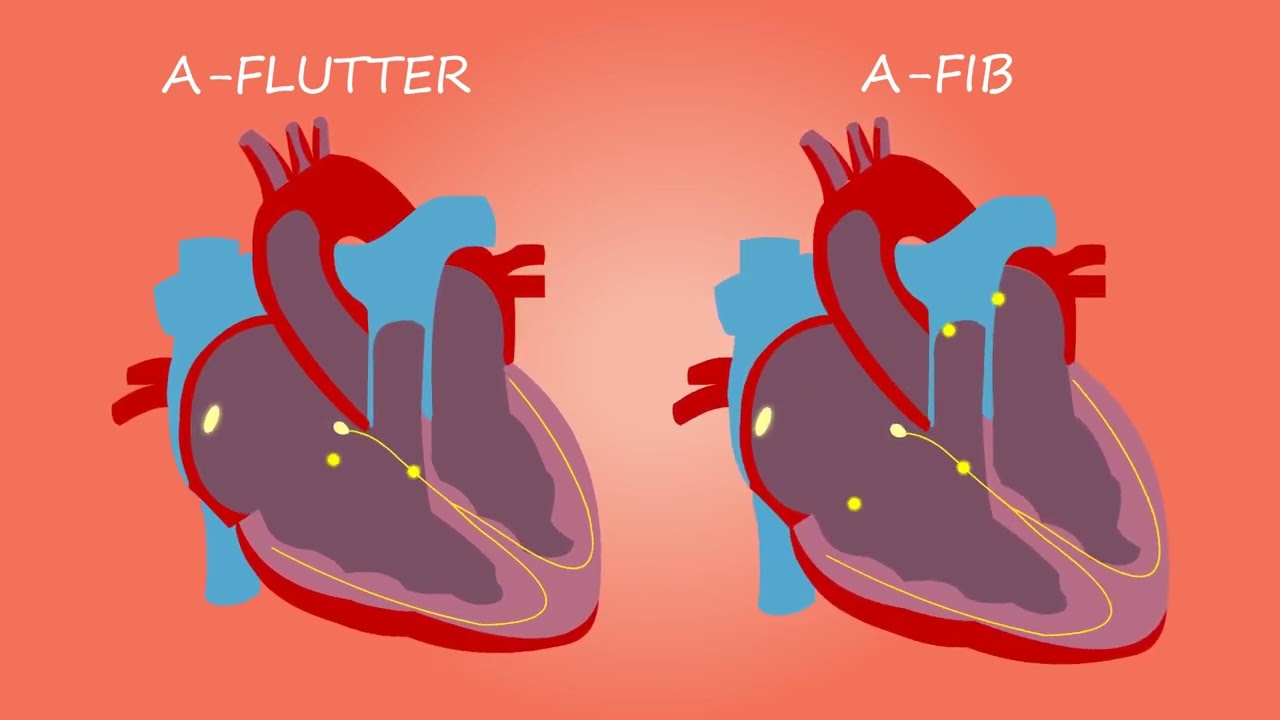 The Role Of Glucofort In Lowering Blood Sugar Levels