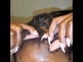 Locs & Bald Spots | Fine Hair| What to do when your hair is growing in #13