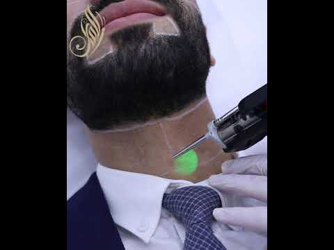 Laser Beard Line