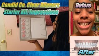 Candid Clear Aligners: Starter Kit Impressions  (Unboxing+Process+Getting Started)