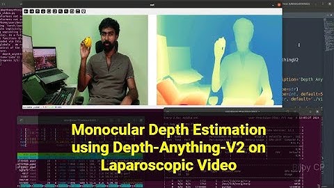 Monocular Depth Estimation using Depth-Anything-V2 on Laparoscopic Video