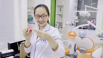 Top 3 hãng Niềng khay trong suốt tại Việt Nam - So sánh có tâm nhất hệ mặt trời