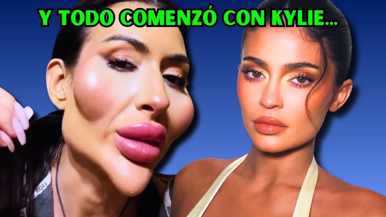 La Plaga Silenciosa: ¿Por Qué Todas Tienen La Misma Cara?