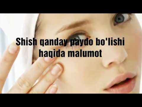 Video: Yuzda Shish Paydo Bo'lishining 5 Sababi