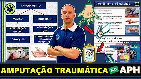 O que não fazer em caso de amputação?
