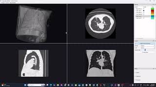 Medical image segmentation using deep learning and interactive visualization application