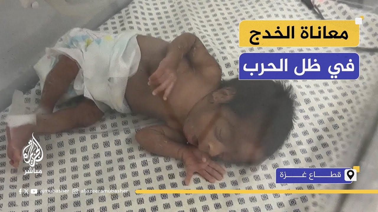 حياة على المحك.. أطفال غزة الخدج يواجهون الموت في ظل الحصار