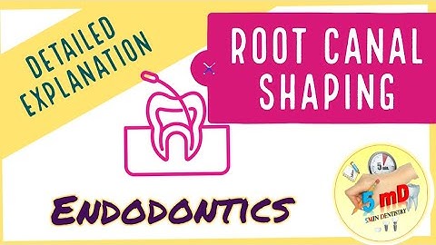 Root canal shaping - Detailed explanation - Step Back & Crown down- Endodontics