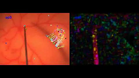 Comparison btw Lucas-Kanade and Dense Optical Flow