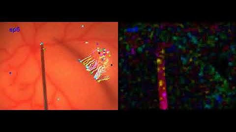 Comparison btw Lucas-Kanade and Dense Optical Flow