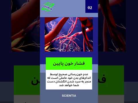 علت سرد بودن دست ها چیست 