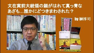 文在寅前大統領の顔がはれて真っ青なあざも…誰かにどつきまわされた？　by榊淳司