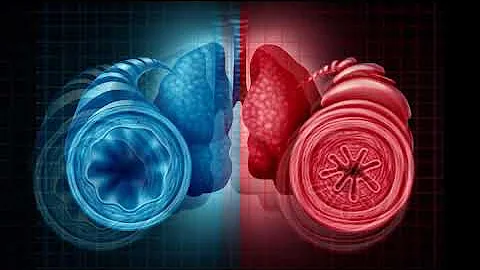 ¿Son graves las sibilancias pulmonares?