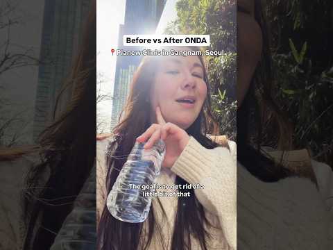 ONDA treatment Korea