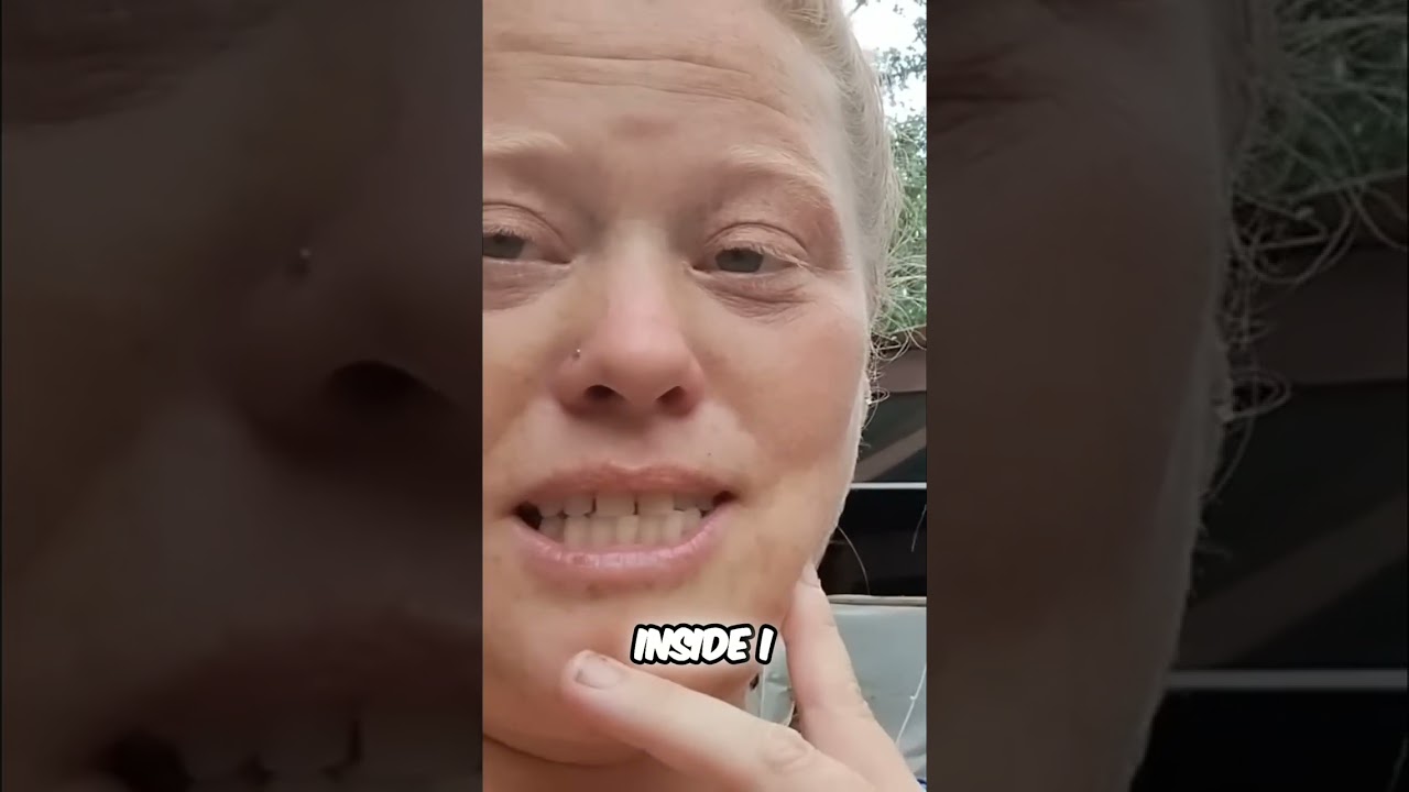 Camp Fire Disaster: See the Bus Damage! 