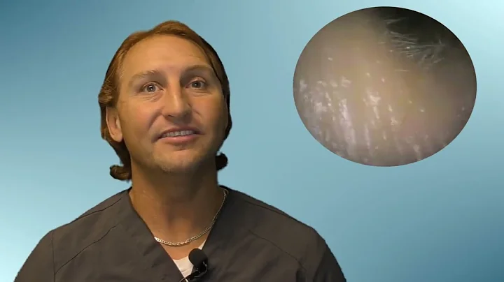 What function does hair in the ear serve? Wax removal VLOG # 67