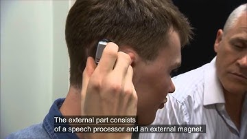 Alex can hear with the Cochlear Baha Attract System