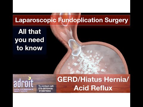 Video: Hiatal Hernias A Acid Reflux