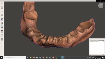 Meshmixer - FAST Virtual Extraction