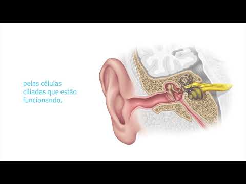 Vídeo: Quando ocorre a perda auditiva neurossensorial?