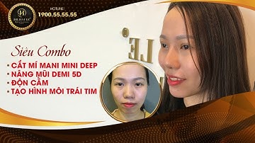 Lột Xác Ngoạn Mục Sau Siêu Combo Nâng mũi+Cắt mí+Độn Cằm+Tạo môi tim