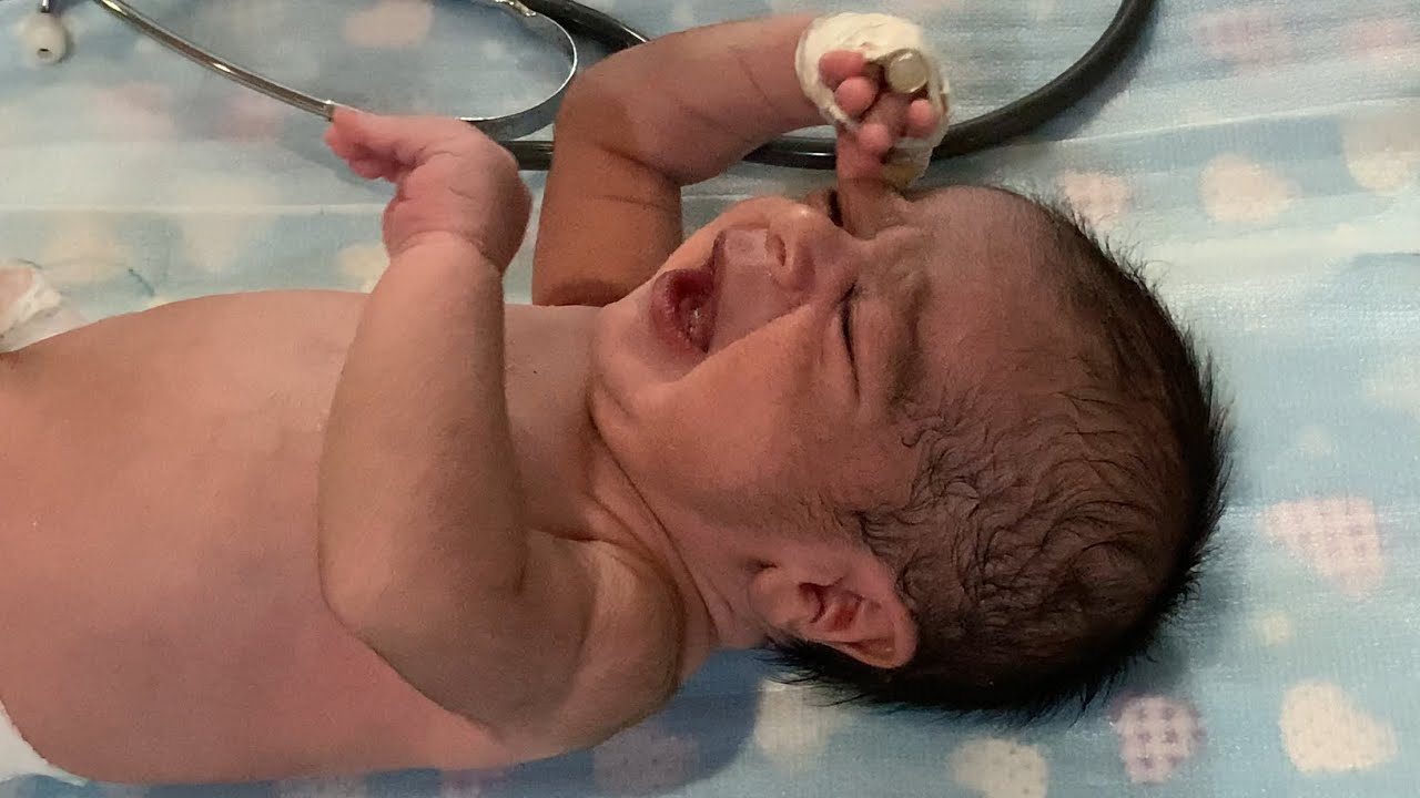 Baby Received From Home With Severe Sinusitis | Emergency Care in NICU 