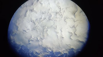 C elegans under microscope