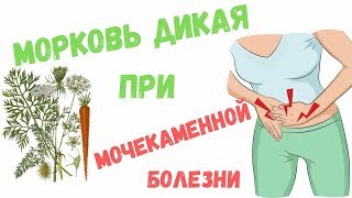 Семена дикой моркови при мочекаменной болезни, полезные свойства семян и способ приготовления