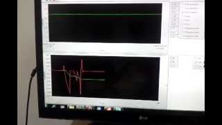 IMU Test - Part 1