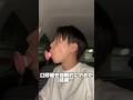 口呼吸で顔面浮腫んだ末路 #口呼吸