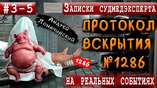 Записки Судмедэксперта | 3. 4. 5. Три Трагичных Истории | Реальные Истории Из Медицинской Практики.