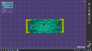 Exocad Model Creator With Support Pin & Name