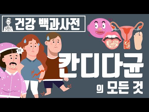 칸디다균의 모든 것 [건강백과사전]