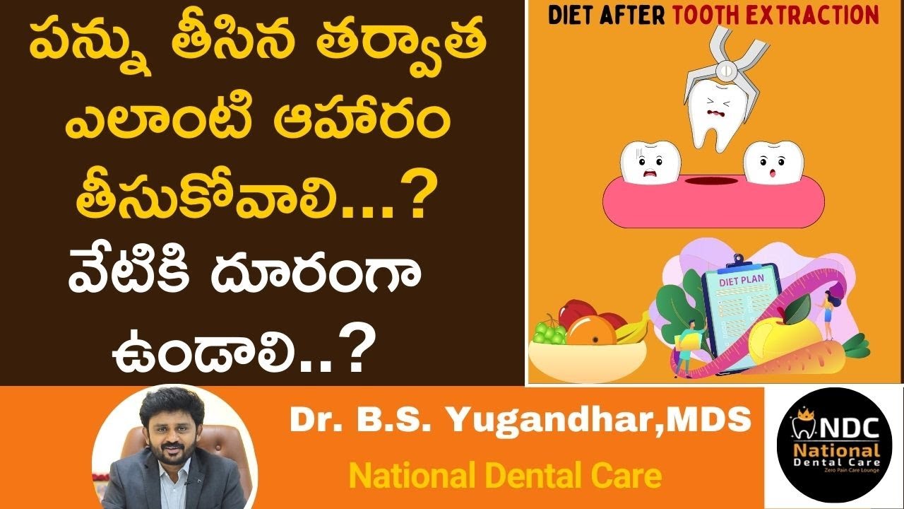 పన్ను తీసిన తర్వాత ఈ డైట్‌ మాత్రమే తీసుకోండి  || Food To Eat / Avoid After Tooth Extraction || NDC