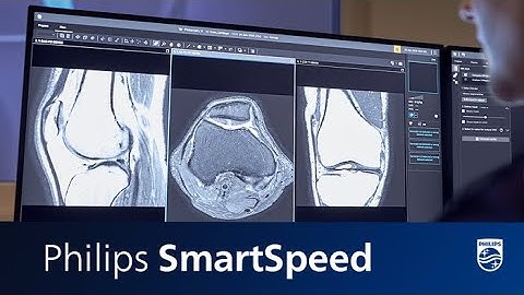 Philips SmartSpeed - Image quality and speed at your fingertips.