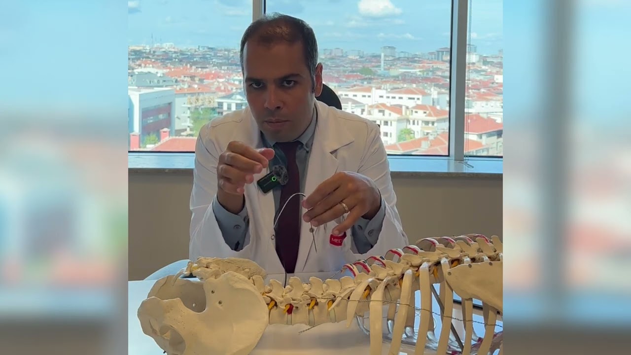 Kırık Sonrası Gelişen Kronik Ağrı (Kompleks Bölgesel Ağrı Sendromu)