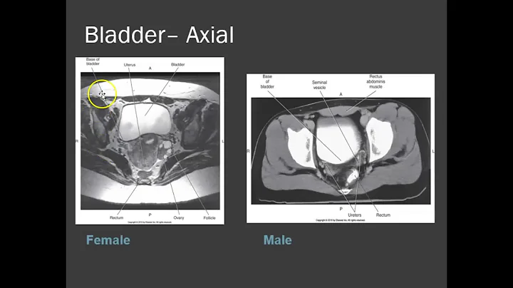 basic pelvic anatomy