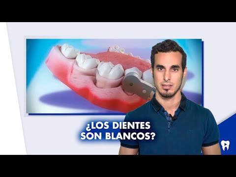 Video: ¿Cuál es el color natural de un diente?