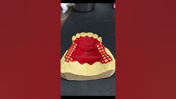 Partial Framework - 3D Printing - Cad Cast Resin Whipmix