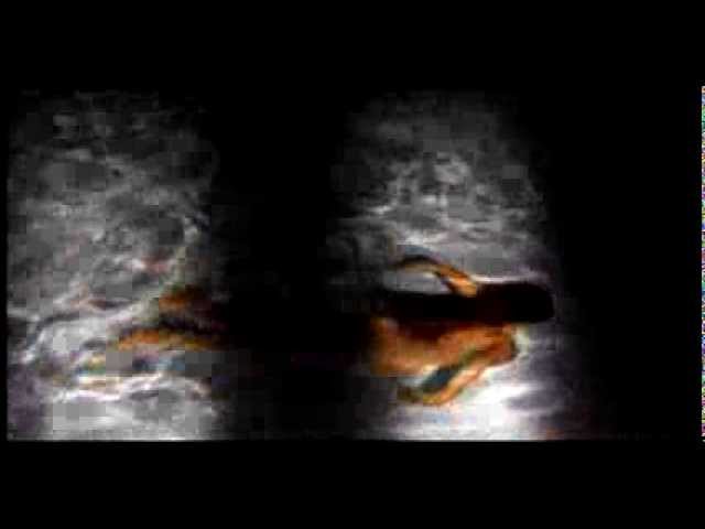Watch Hopeless - Beyond (Official Video) on YouTube Watch Hopeless - Beyond (Official Video) on YouTube