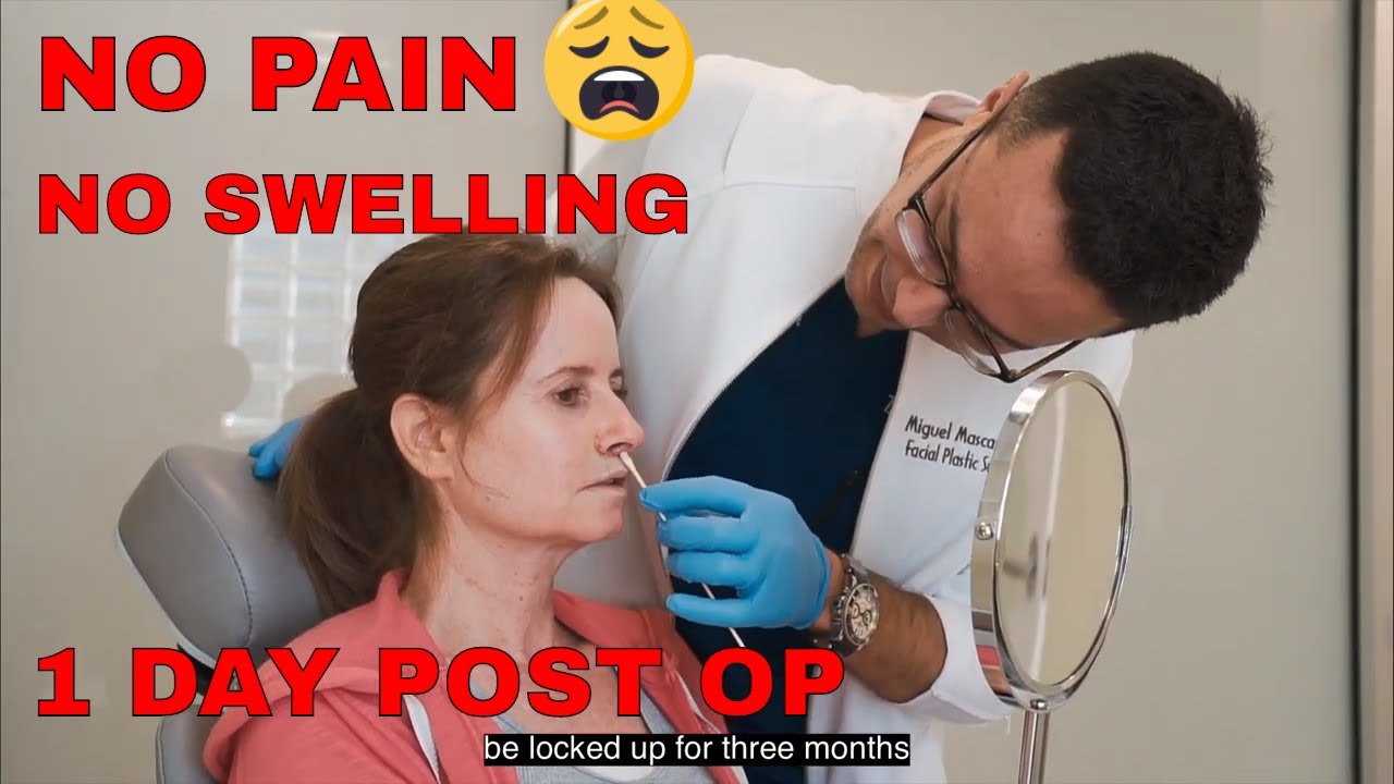 LIP LIFT NEAR ME - Lip Lift | Dr. Mascaro - YouTube